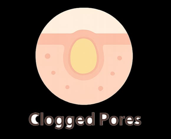 Clogged Pores
